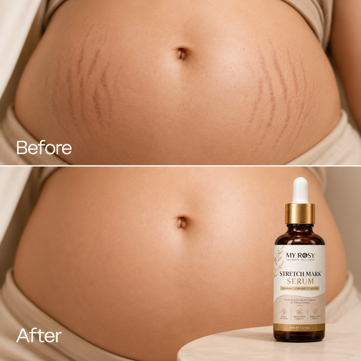 Stretch Mark Serum